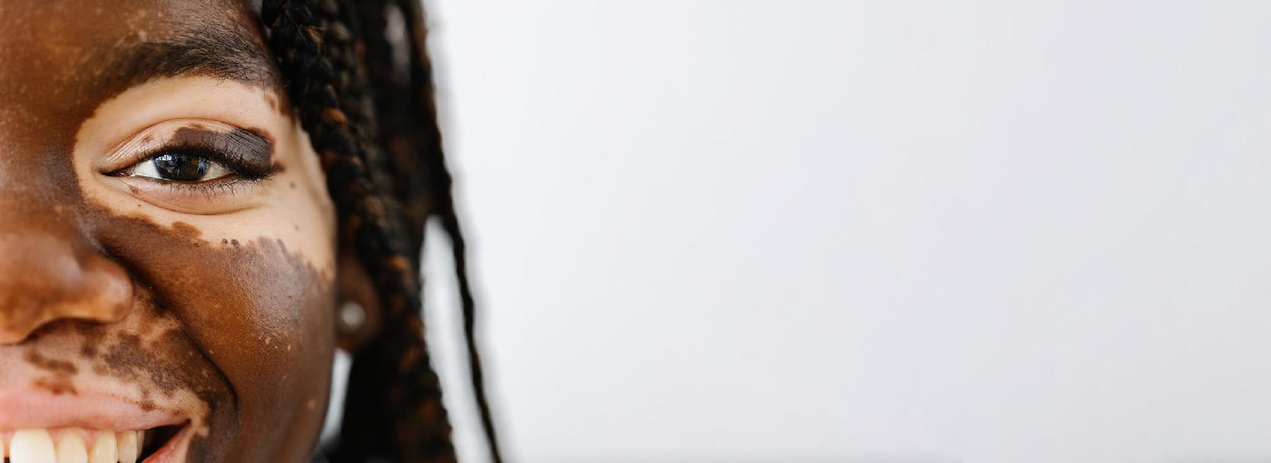 KONSERVATIVE DERMATOLOGIE