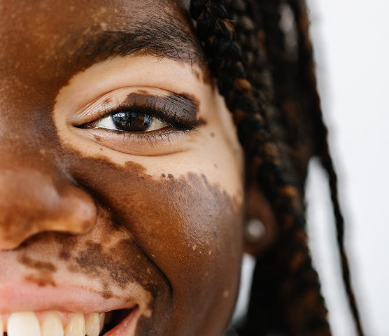 KONSERVATIVE DERMATOLOGIE